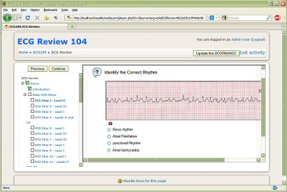 ECG Screen